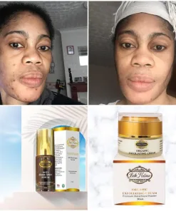 Le visage d'une femme est montré avant et après l'utilisation du SÉRUM CONTRE LES TÂCHES SOMBRES BELLE NUBIAN ; en dessous se trouvent des images de deux produits de soin emballés.