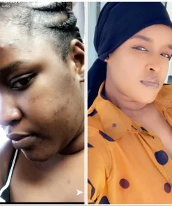 Photos côte à côte de la même femme : à gauche, elle a les cheveux tressés et le visage nu ; à droite, elle porte un foulard et un chemisier à pois marron, tient un flacon de GLUTA BIO ULTIME (2000 mg) et fait face à l'appareil photo.